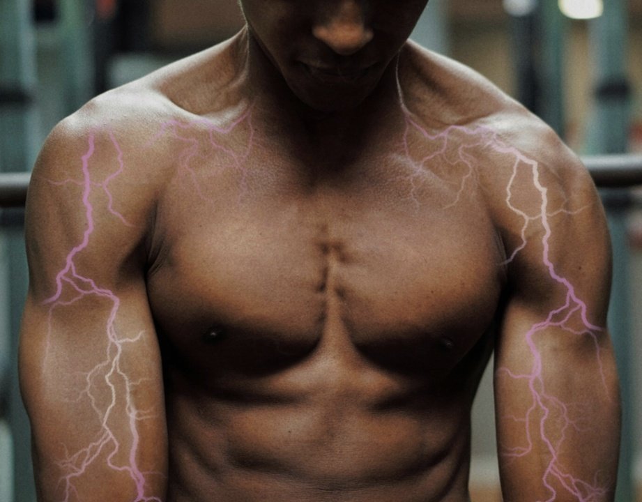 electrical muscle stimulation therapy